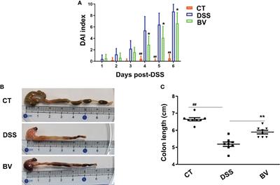 Bacteroides vulgatus attenuates experimental mice colitis through modulating gut microbiota and immune responses